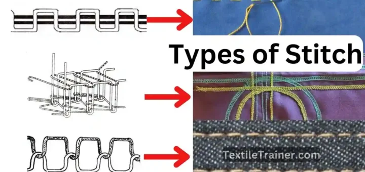Types of Stitches